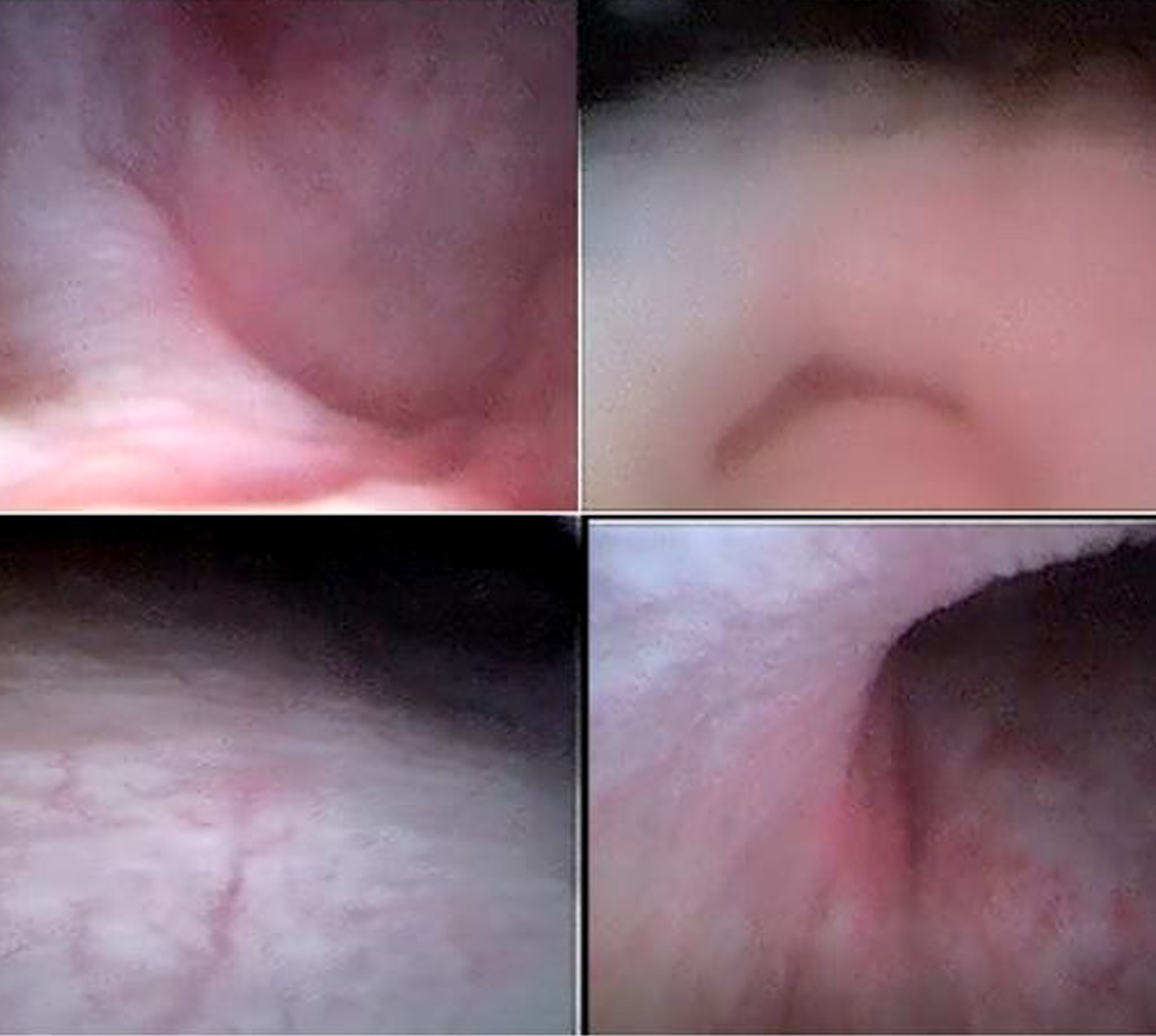 一次性使用电子膀胱镜动物实验研究