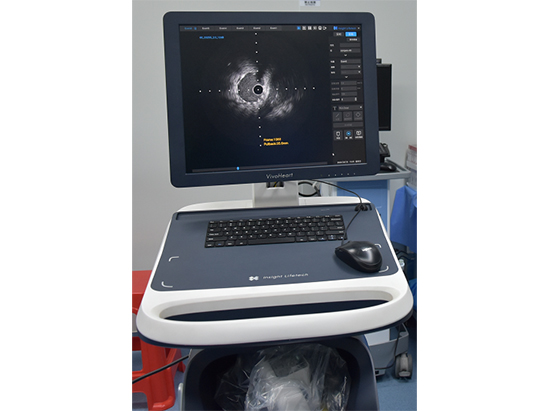 血管内超声成像（IVUS）完成临床前动物实验研究