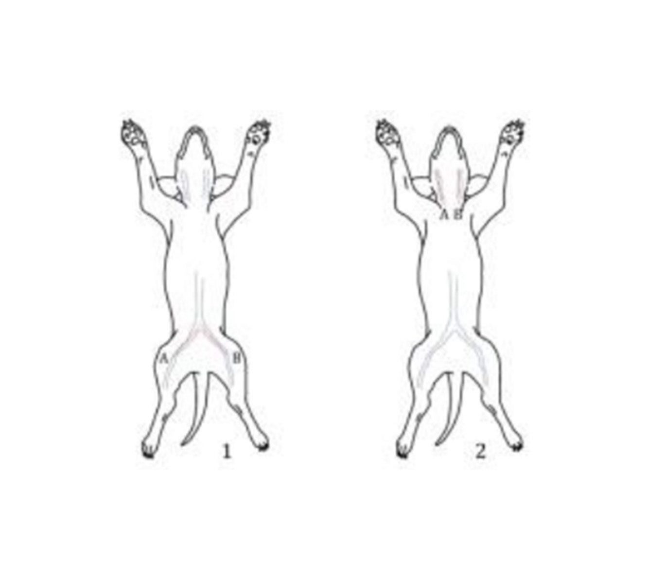 体内血栓形成
