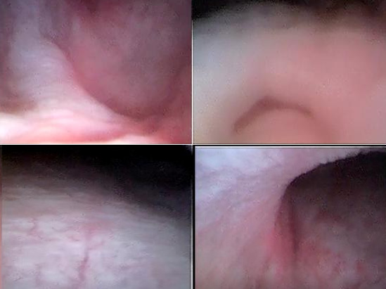 一次性使用电子膀胱镜动物实验研究