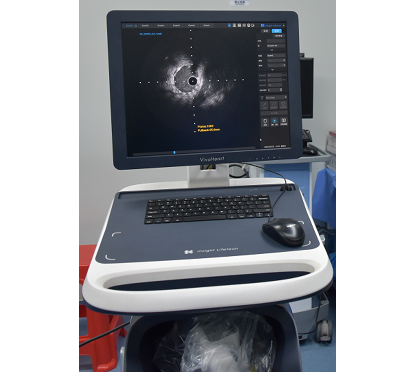 血管内超声成像（IVUS）完成临床前动物实验研究