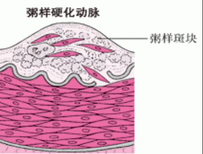 心脑血管疾病动物模型