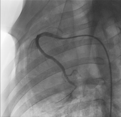 血管内超声成像（IVUS）完成临床前动物实验研究