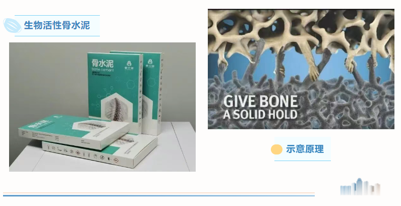 骨水泥产品