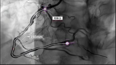 血管内超声成像（IVUS）完成临床前动物实验研究
