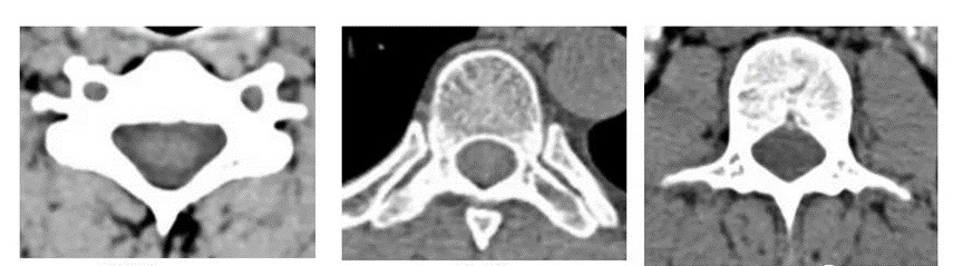 超声骨刀完成临床前动物实验分享