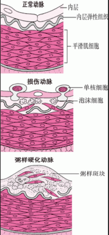 心脑血管疾病动物模型